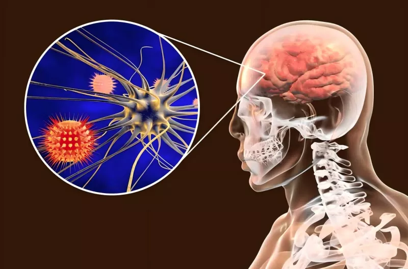 Hướng dẫn về vắc xin ngừa não mô cầu Hướng dẫn về vắc xin ngừa não mô cầu